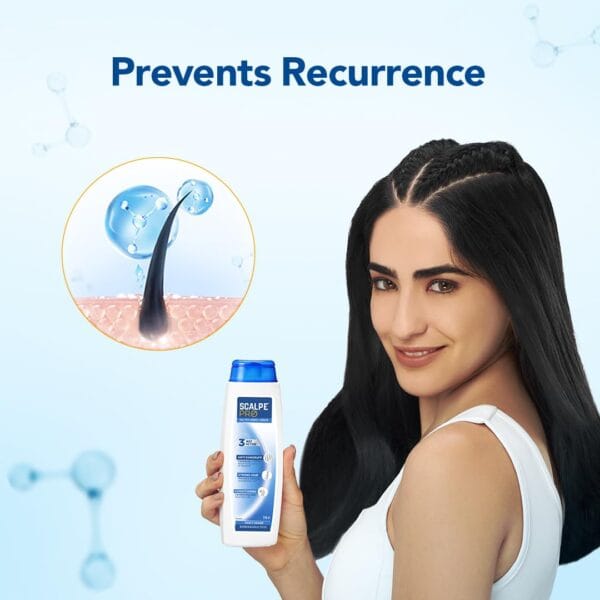 61mEnyVE++L._SL1080_ Scalpe Pro Daily Anti-Dandruff Shampoo – Dandruff Control (2026)