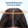 61wvBd5JjFL._SL1080_ Scalpe Pro Daily Anti-Dandruff Shampoo – Dandruff Control (2026)