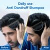 71ehsst1VuL._SL1500_ Scalpe Pro Daily Anti-Dandruff Shampoo – Dandruff Control (2026)