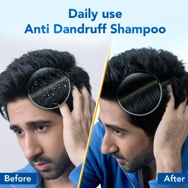 71ehsst1VuL._SL1500_ Scalpe Pro Daily Anti-Dandruff Shampoo – Dandruff Control (2026)